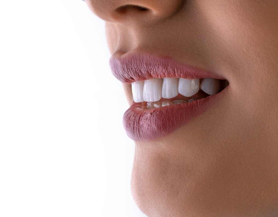Come migliorare il sorriso con l’ortodonzia invisibile