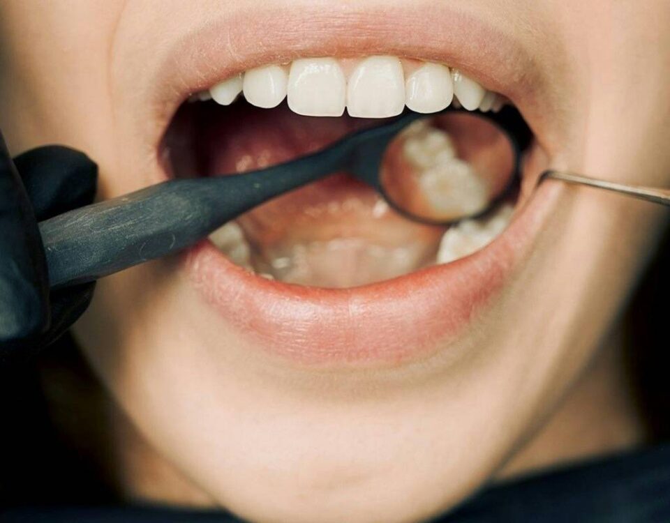 Sensibilità dei denti: cause, sintomi e trattamenti